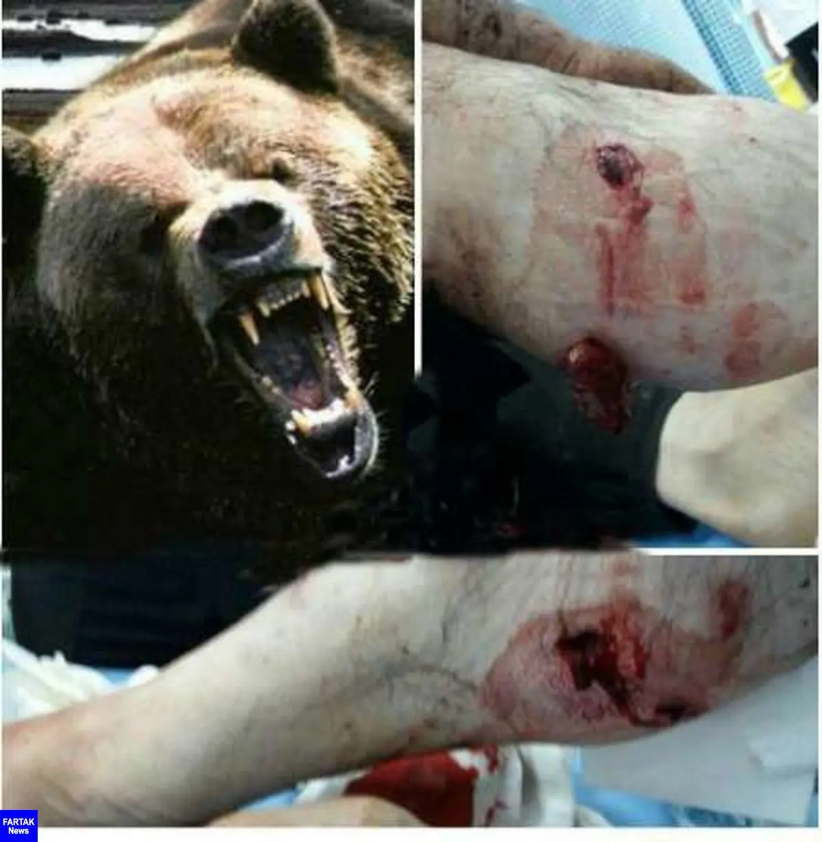 حمله خرس به کودک 10 ساله در چهارمحال و بختیاری + عکس