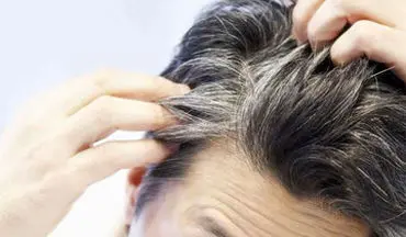 علت سفیدی مو از نظر طب سنتی چیست؟