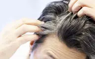 علت سفیدی مو از نظر طب سنتی چیست؟