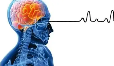 اولین علت سکته مغزی چیست؟/وضعیت فشار خون ایرانی ها