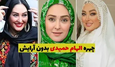 فیلم لو رفته از صورت بدون آرایش الهام حمیدی را ببینید