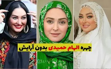 فیلم لو رفته از صورت بدون آرایش الهام حمیدی را ببینید