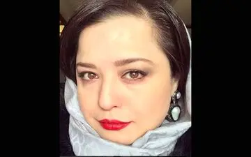  ماجرای خط روی پیشانی مهرآوه شریفی نیا چه بود؟! + عکس