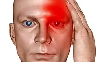 علل سردرد در نواحی مختلف چیست؟