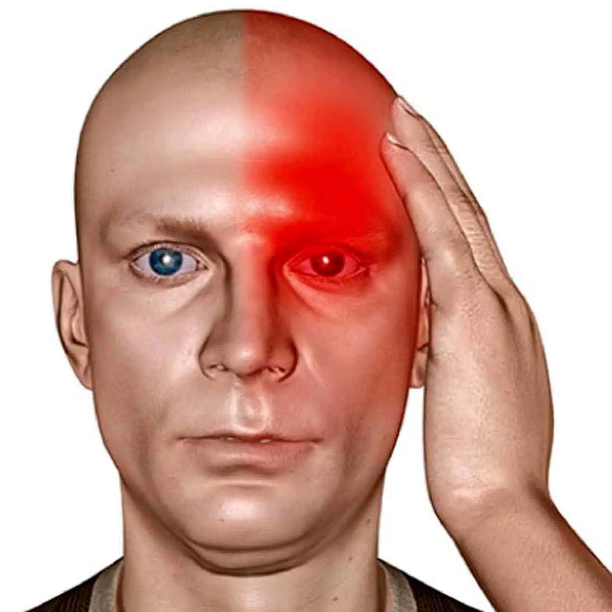   علل سردرد در نواحی مختلف چیست؟ 