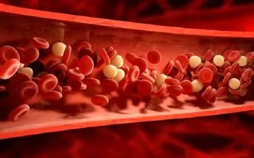 با این خوراکی چربی خون را کاهش دهید