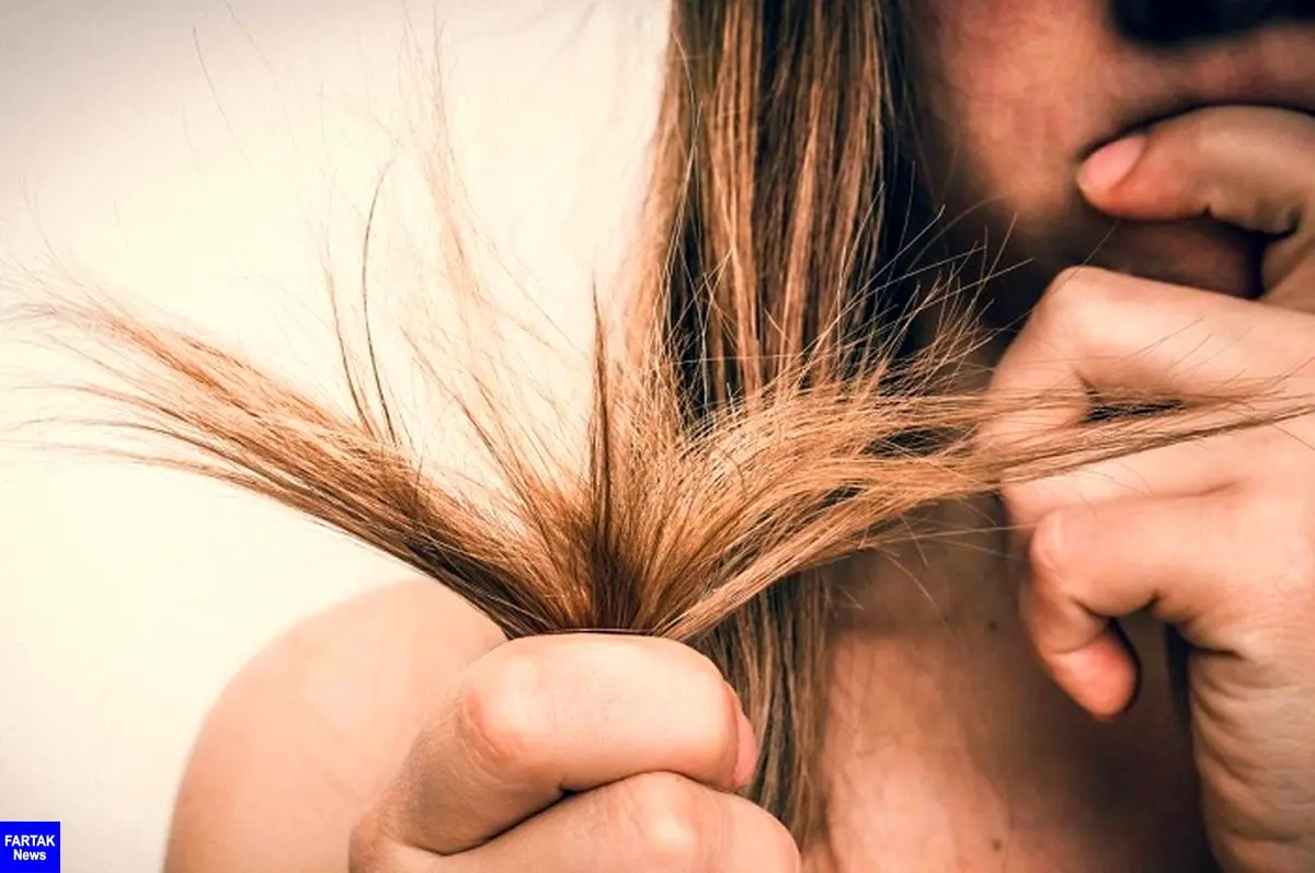 بدون کوتاه کردن مو از موخوره جلوگیری کنید| انواع روش‌های رفع موخوره