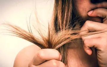 خداحافظی با چند شاخه‌ها! هر آنچه باید درباره موخوره و روش‌های رفع آن بدانید