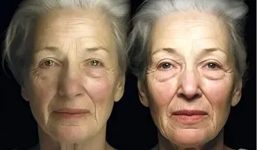 سیر پیری بدن از چه سنی به یکباره شتاب می‌گیرد؟