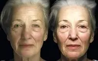 سیر پیری بدن از چه سنی به یکباره شتاب می‌گیرد؟