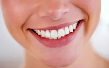 از بین بردن لکه‌های سیاه روی دندان؛ راهکارهایی برای لبخندی زیباتر