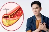 چگونه خشکبار به مدیریت کلسترول کمک میکند؟


