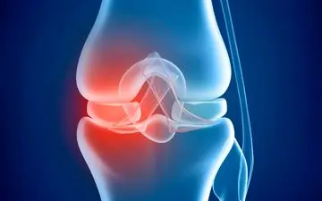 از دلایل تا درمان پوکی استخوان