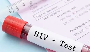  بیماران HIV اگر این نکات را بدانند سالم زندگی می کنند!