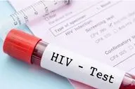  بیماران HIV اگر این نکات را بدانند سالم زندگی می کنند!