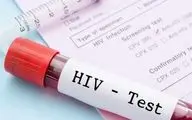  بیماران HIV اگر این نکات را بدانند سالم زندگی می کنند!