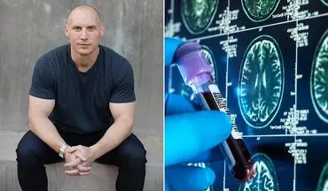 دستاوردهای باورنکردنی در زمینه پیوند اعضا/ از چاپ سه‌بعدی اندام‌ها تا بازسازی آلت تناسلی با انگشت!