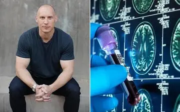 دستاوردهای باورنکردنی در زمینه پیوند اعضا/ از چاپ سه‌بعدی اندام‌ها تا بازسازی آلت تناسلی با انگشت!