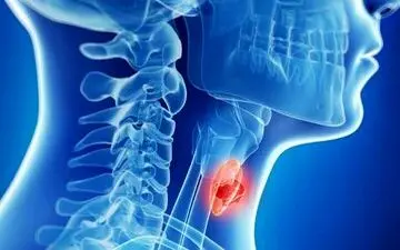 این سرطان در زنان رایج تر از مردان است
