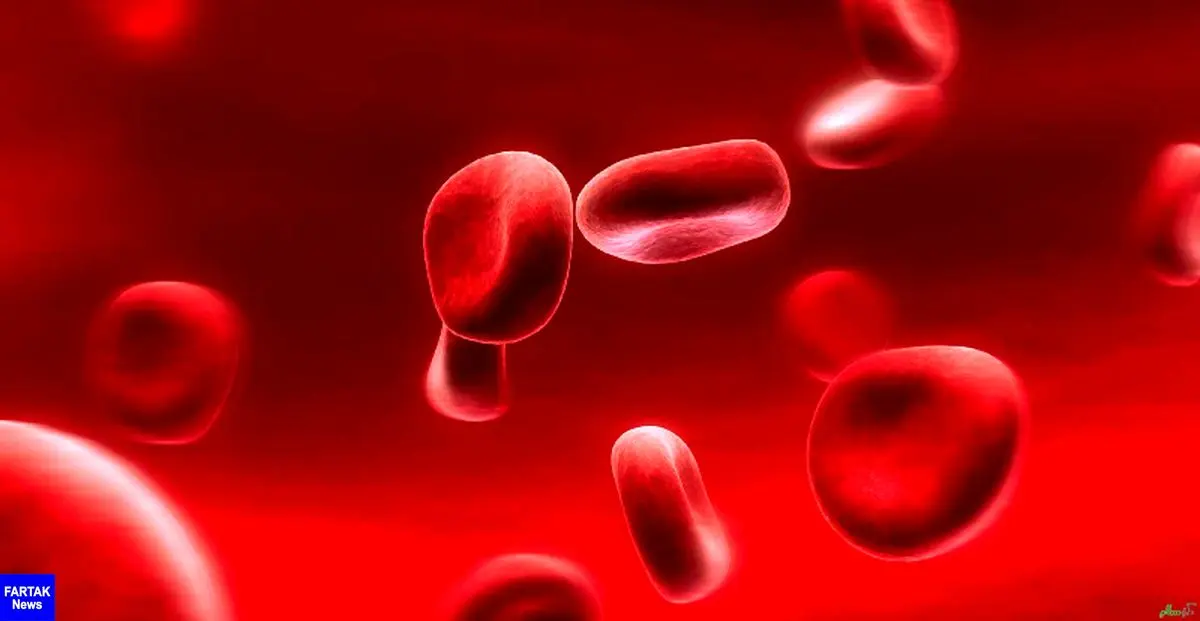 کم خونی در مردان نشانه کدام بیماری خطرناک است؟