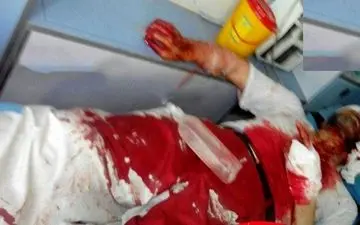 روحانی حادثه مترو شهرری 15 درصد هوشیاری دارد / او یک قاضی بوده است! + عکس 