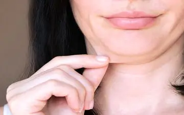 مشکلات پوست بعد از عمل بینی را بدانید