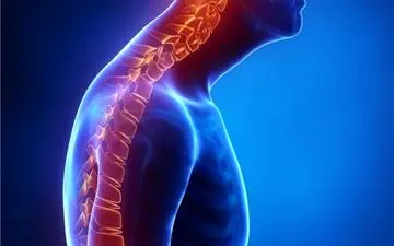 افتادگی شانه‌ها|علت و راه‌های درمان افتادگی شانه را بدانید