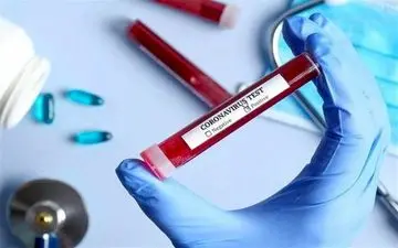  اردبیل از لحاظ شروع بیماری کرونا در وضعیت قرمز قرار دارد