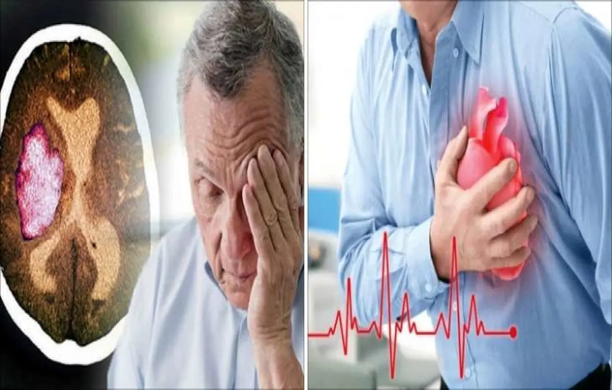فرق سکته مغزی و قلبی| علائم سکته مغزی و قلبی چیست؟