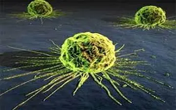 ۵ نشانه موذی ترین سرطان در بدن