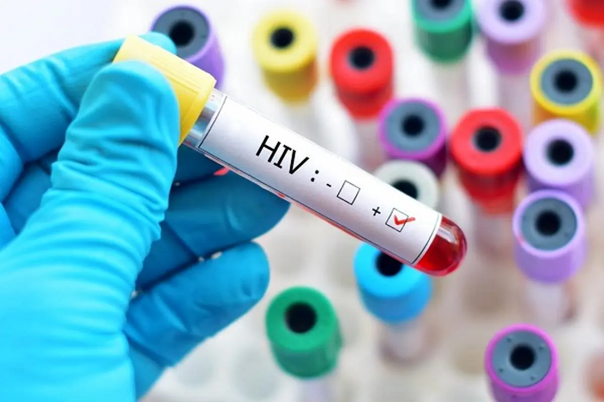 ویروس اچ آی وی را بهتر بشناسیم