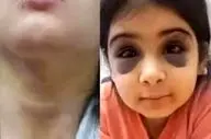 کودک ۹ ساله سنندجی قربانی خشونت نامادری/ پرونده به دادگستری ارجاع شد