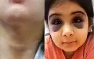 کودک ۹ ساله سنندجی قربانی خشونت نامادری/ پرونده به دادگستری ارجاع شد