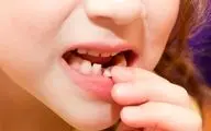 دندان‌های شیری بی اهمیت هستند؟