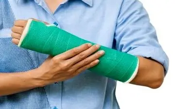علت عجیب شکستگی استخوان که باورتان نمی شود