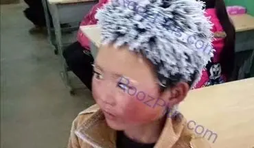 پسربچه ای که موهایش به خاطر امتحان یک شبه سفید شد! +تصاویر