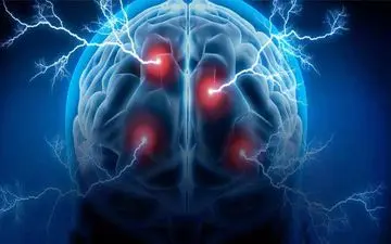 مهم ترین علائم سکته مغزی