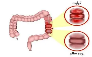 به این ۶ دلیل شما دچار مشکلات گوارشی می شوید