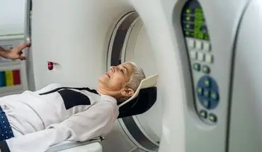 MRI ابزاری برای تشخیص سریع زوال عقل 