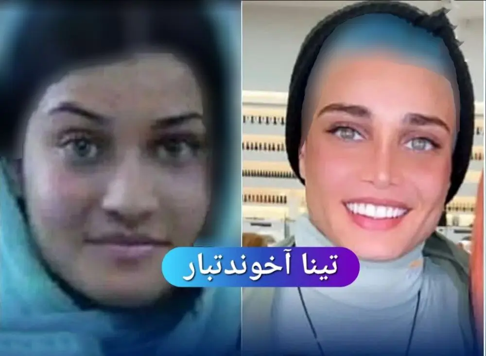 عکس بازیگران زن ایرانی قبل و بعد از عمل زیبایی