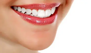 ۴ روش پزشکی و ۱۲ روش‌ خانگی سفید کردن دندان 