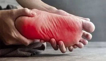 داغی کف پا در شب نشانه ابتلا به این بیماری است