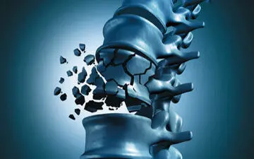 با این گیاه استخوان خود را تقویت کنید
