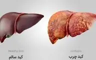 با این سه مورد کبد چرب تان را درمان کنید
