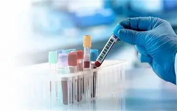 نتیجه آزمایش خون برای سرطان تخمدان چقدر دقیق است؟