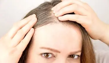 این عادات موجب سفید شدن مو در خانم‌ها می‌شود؛ لطفا سریعتر آن‌ها را ترک کنید!