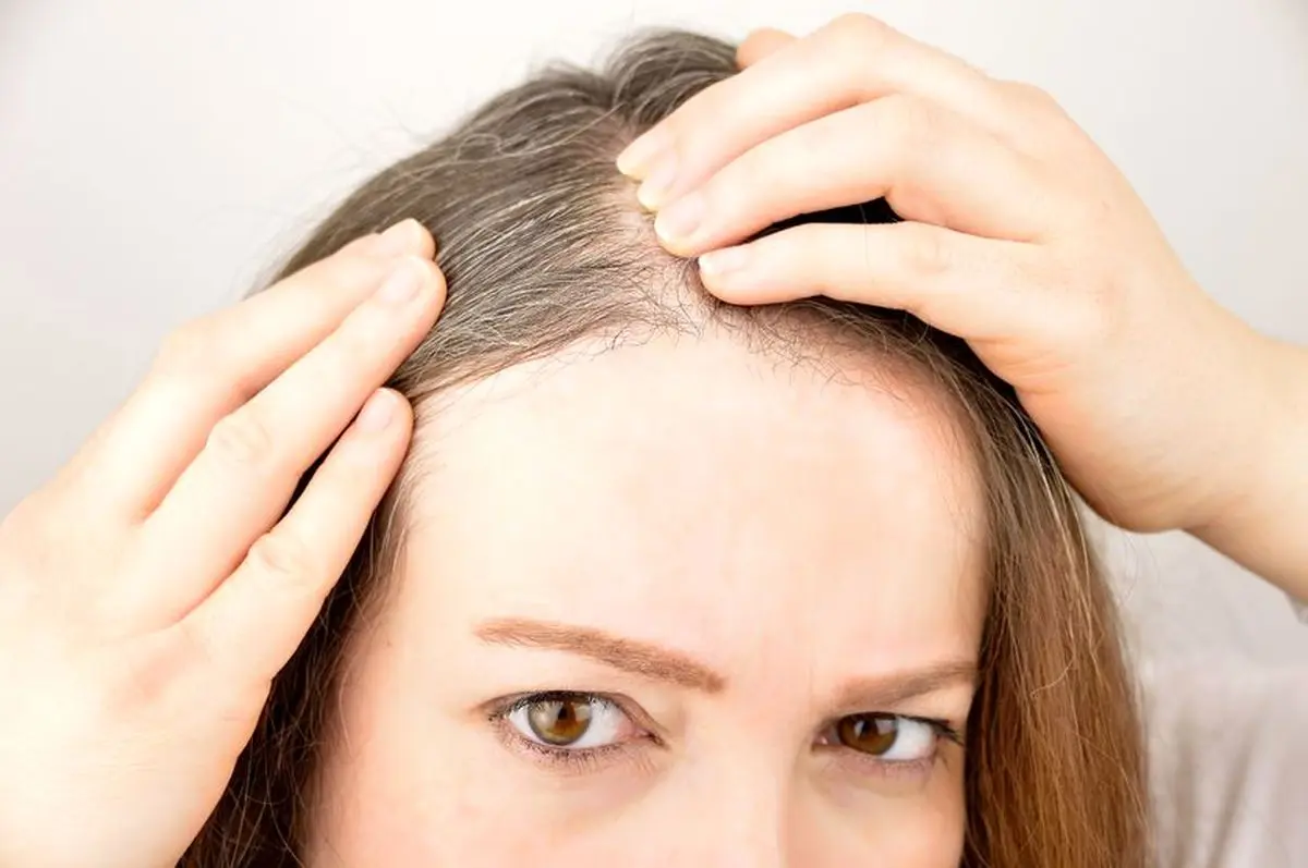 این عادات موجب سفید شدن مو در خانم‌ها می‌شود؛ لطفا سریعتر آن‌ها را ترک کنید!