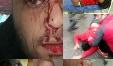 چاقوکشی خونین پس از دربی مازندران در لیگ دسته اول فوتبال + عکس