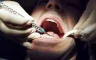 دلیل تعرفه‌های متغیر دندانپزشکی
