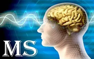 داروی جدید درمان «ام اس» تایید شد 